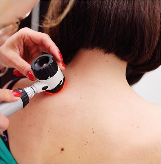 Vorsorgeuntersuchung Hautkrebs in Krems