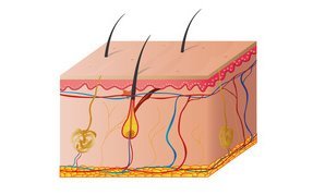 Hautarzt-Krems-Melanom-1